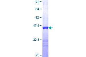 ICA1 Protein (AA 1-110) (GST tag)