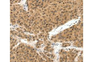 Immunohistochemistry (IHC) image for anti-Telomeric Repeat Binding Factor 2 (TERF2) antibody (ABIN2426457) (TRF2 antibody)