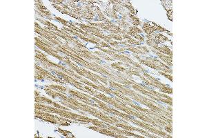 Immunohistochemistry of paraffin-embedded mouse heart using CDC42 Rabbit pAb (ABIN3021670, ABIN3021671, ABIN3021672 and ABIN6215499) at dilution of 1:50 (40x lens).