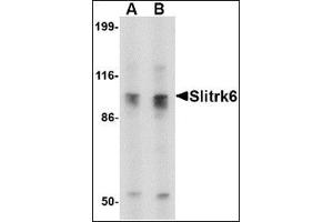 Western blot analysis of Slitrk6 in SK-N-SH cell lysate with this product at (A) 0. (SLITRK6 antibody  (C-Term))