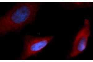 Immunofluorescence (IF) image for anti-Interleukin 15 (IL15) (AA 49-162) antibody (PE) (ABIN5565745) (IL-15 antibody  (AA 49-162) (PE))