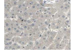 Detection of MTUS1 in Human Liver Tissue using Polyclonal Antibody to Mitochondrial Tumor Suppressor 1 (MTUS1) (MTUS1 antibody  (AA 1018-1270))