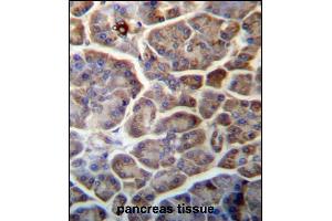 SNX29 Antibody (C-term) (ABIN657262 and ABIN2846357) immunohistochemistry analysis in formalin fixed and paraffin embedded human pancreas tissue followed by peroxidase conjugation of the secondary antibody and DAB staining. (SNX29 antibody  (C-Term))