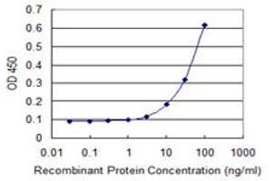 Detection limit for recombinant GST tagged TIMM8B is 3 ng/ml as a capture antibody. (TIMM8B antibody  (AA 1-83))