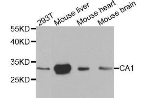 Western blot analysis of extracts of various cell lines, using CA1 antibody. (CA1 antibody  (AA 1-261))