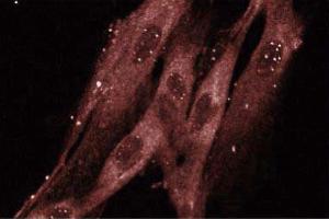 Immunofluorescence staining of WI-38 cells (human lung fibroblasts, ATCC CCL-75). (RAB8A antibody  (AA 84-205))