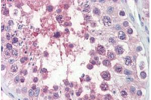 Human Testis (formalin-fixed, paraffin-embedded) stained with TRIM8 antibody ABIN462222 followed by biotinylated goat anti-rabbit IgG secondary antibody ABIN481713, alkaline phosphatase-streptavidin and chromogen. (TRIM8 antibody  (AA 36-85))