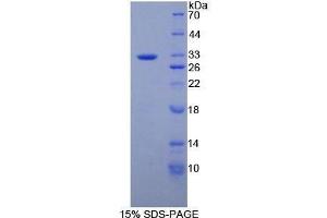 SDS-PAGE (SDS) image for Protein tyrosine Phosphatase, Receptor Type, B (PTPRB) (AA 1655-1918) protein (His tag) (ABIN2126538) (PTPRB Protein (AA 1655-1918) (His tag))