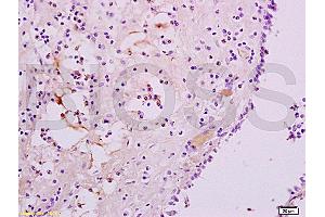 Formalin-fixed and paraffin embedded human nasal mucosa tissue labeled with Anti-CXCR3/CD183 Polyclonal Antibody, Unconjugated (ABIN739014) at 1:200, followed by conjugation to the secondary antibody and DAB staining (CXCR3 antibody  (AA 1-100))