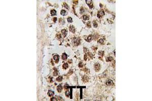 Formalin-fixed and paraffin-embedded human testis tissue reacted with MLLT10 polyclonal antibody  , which was peroxidase-conjugated to the secondary antibody, followed by DAB staining. (MLLT10 antibody  (C-Term))