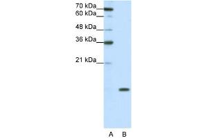 WB Suggested Anti-SNRPD1 Antibody Titration:  0.