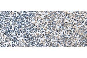 Immunohistochemistry of paraffin-embedded Human tonsil tissue using PLA2G16 Polyclonal Antibody at dilution of 1:40(x200) (PLA2G16 antibody)