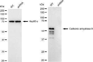 Western blotting analysis using Carbonic anhydrase 9 antibody (ABIN7797869).