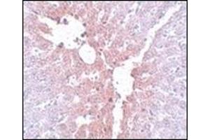 Immunohistochemistry of KLF4 in rat liver tissue with this product at 5 μg/ml.