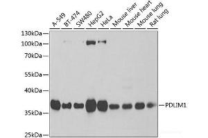 Western blot analysis of extracts of various cell lines using PDLIM1 Polyclonal Antibody at dilution of 1:1000. (PDLIM1 antibody)