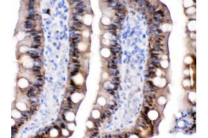 Immunohistochemistry (IHC) image for anti-Fatty Acid Binding Protein 2, Intestinal (FABP2) (AA 2-38), (N-Term) antibody (ABIN4886576)