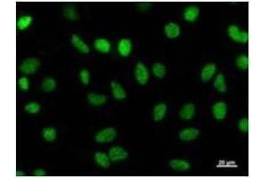 Immunostaining analysis in HeLa cells. (HEXIM1 antibody)