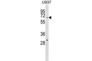 Western Blotting (WB) image for anti-Regulator of G-Protein Signaling 14 (RGS14) antibody (ABIN2998924) (RGS14 antibody)