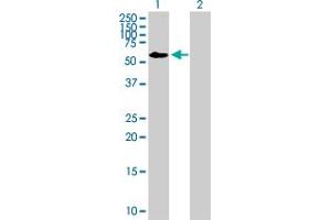 Western Blot analysis of FRMD8 expression in transfected 293T cell line by FRMD8 MaxPab polyclonal antibody. (FRMD8 antibody  (AA 1-464))