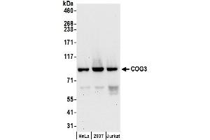anti-Component of Oligomeric Golgi Complex 3 (COG3) (AA 1-50) antibody