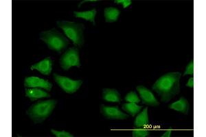 Immunofluorescence of monoclonal antibody to TXN on HeLa cell. (TXN antibody  (AA 1-105))