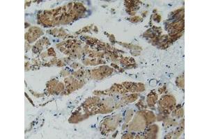 IHC-P analysis of rectum tissue, with DAB staining. (Plastin 3 antibody  (AA 234-475))