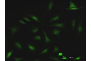 Immunofluorescence of purified MaxPab antibody to CCDC6 on HeLa cell.