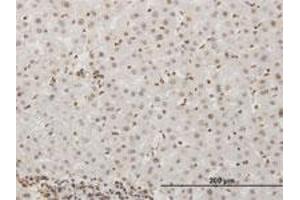 Immunoperoxidase of polyclonal antibody to Phospho-MET Y1349 on formalin-fixed paraffin-embedded human liver. (c-MET antibody  (pTyr1349))
