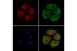 ABIN6260302 and ABIN6279203 staining Hela cells by IF/ICC.