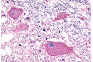 Anti-BAI3 antibody  ABIN1048344 IHC staining of human brain, neurons. (BAI3 antibody  (Cytoplasmic Domain))