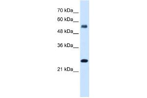 SMAD1 antibody - N-terminal region  validated by WB using Transfected 293T cell lysate at 2. (SMAD1 antibody  (N-Term))