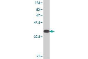 Western Blot detection against Immunogen (36. (UPF3A antibody  (AA 382-475))