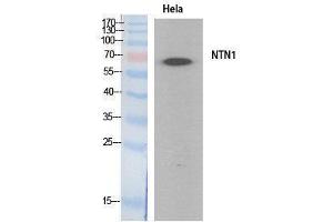 Western Blotting (WB) image for anti-Netrin 1 (NTN1) (Internal Region) antibody (ABIN3181063) (Netrin 1 antibody  (Internal Region))