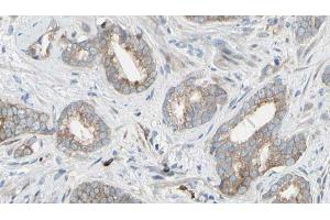 ABIN6268954 at 1/100 staining Human prostate tissue by IHC-P. (EIF4B antibody  (Internal Region))