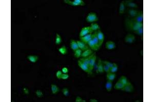 Immunofluorescence staining of HepG2 cells with ABIN7158287 at 1:66, counter-stained with DAPI. (LTK antibody  (AA 20-175))