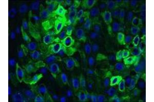 Immunohistochemistry on frozen section of human oesophagus (KRT16 antibody)