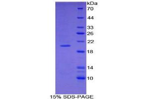 SDS-PAGE analysis of Mouse COL3A1 Protein.