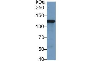 Western Blot; Sample: Human HepG2 cell lysate; Primary Ab: 1µg/ml Rabbit Anti-Human HK2 Antibody Second Ab: 0.