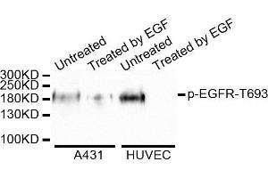 Western blot analysis of extracts of A431 cell lines, using Phospho-EGFR-T693 antibody. (EGFR antibody  (pThr669))