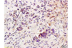 Immunohistochemistry (IHC) image for anti-Colony Stimulating Factor 3 (Granulocyte) (CSF3) (AA 155-198) antibody (ABIN736521)