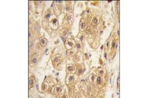 Image no. 2 for anti-Platelet Derived Growth Factor Receptor beta (PDGFRB) antibody (ABIN359922) (PDGFRB antibody)