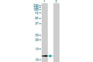Western Blot analysis of RAB42 expression in transfected 293T cell line by RAB42 MaxPab polyclonal antibody. (RAB42 antibody  (AA 1-105))