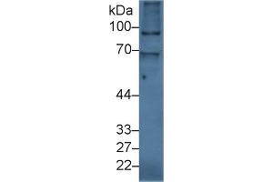 Western Blotting (WB) image for anti-Inter-alpha Globulin Inhibitor H2 Polypeptide (ITIH2) (AA 452-702) antibody (ABIN7436561)