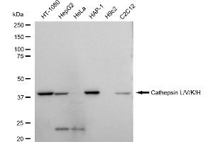 Western blotting analysis using Cathepsin L/V/K/H antibody (ABIN7797941). (Recombinant Cathepsin LVKH antibody)