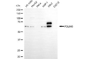 Western blotting analysis using PDLIM5 antibody (ABIN7799750).