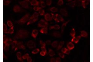 ABIN6274737 staining HuvEc by IF/ICC. (MRPL24 antibody  (Internal Region))