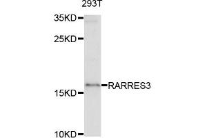 Western blot analysis of extracts of 293T cells, using RARRES3 antibody. (RARRES3 antibody)