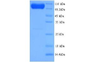 SDS-PAGE (SDS) image for SMAD Specific E3 Ubiquitin Protein Ligase 2 (SMURF2) (AA 1-748), (full length) protein (His tag) (ABIN5714482)