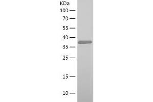 Neuregulin 1 Protein (NRG1) (AA 119-237) (His-IF2DI Tag)