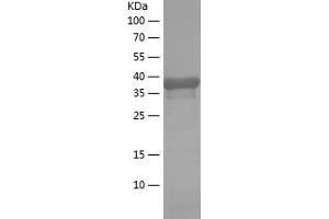 Western Blotting (WB) image for Calbindin 2 (CALB2) (AA 1-159) protein (His-IF2DI Tag) (ABIN7122075) (Calretinin Protein (AA 1-159) (His-IF2DI Tag))